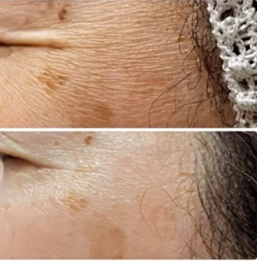  乾燥からの小ジワ、シミ改善！