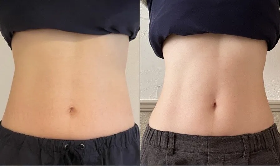 ソフトでリラックスできる腸もみ