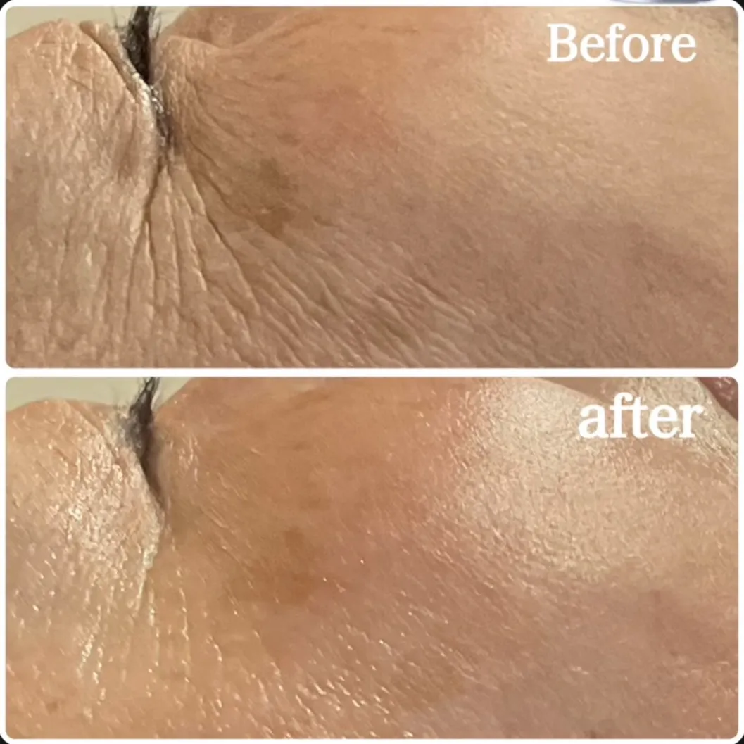 エステで叶う福岡県北九州市のリフトアップ施術と効果的な選び方ガイド