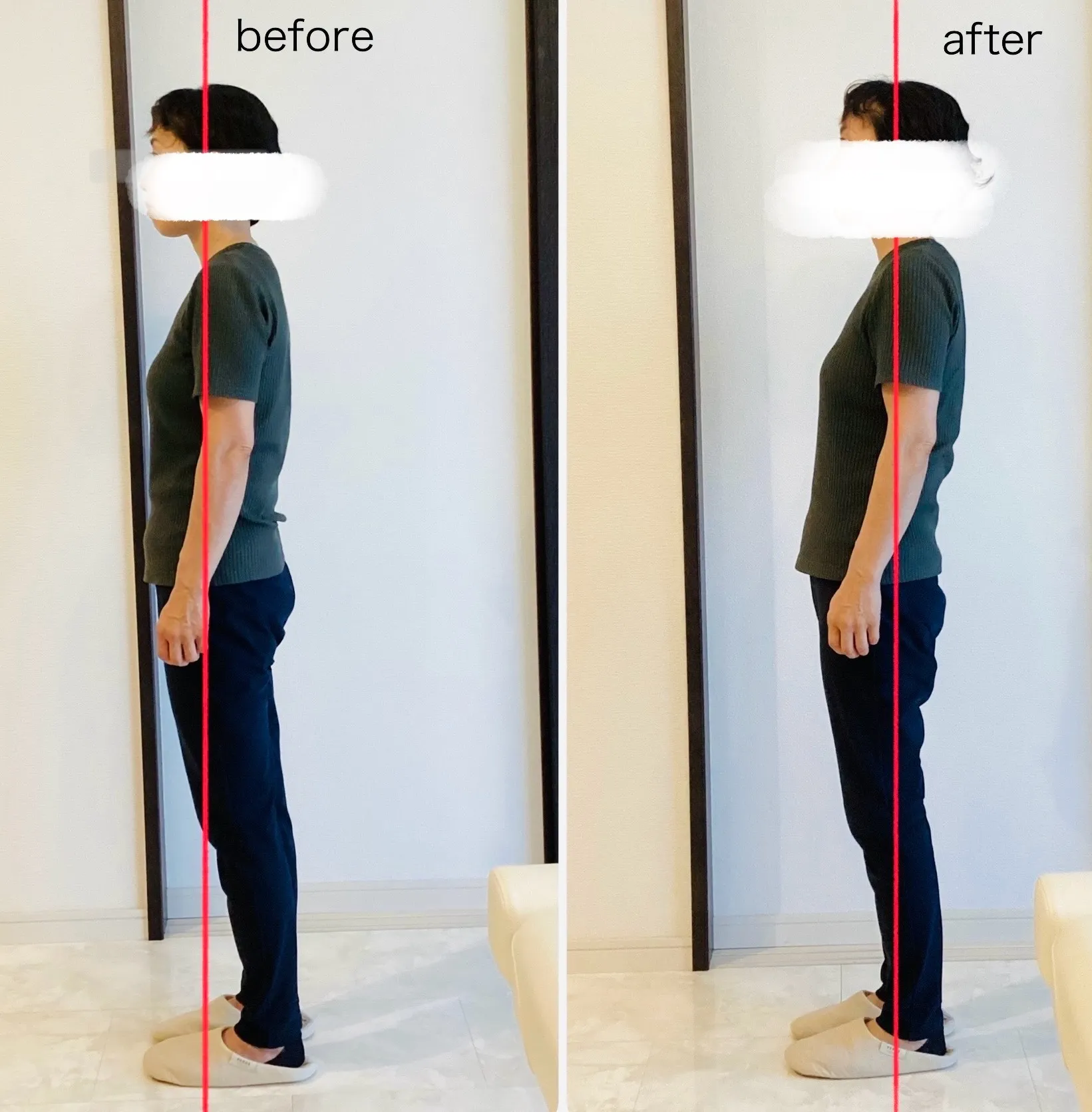 整体のビフォーアフターで実感する変化と継続の大切さを徹底解説