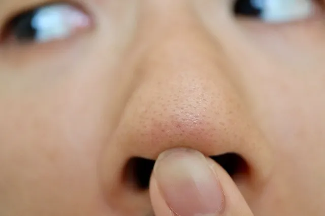 いちご鼻に毛が生えてる男性必見！原因と正しい改善法を徹底解説