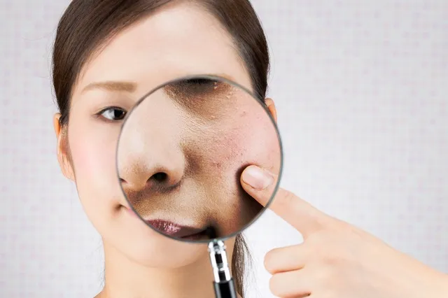 毛穴汚れ本当に落ちる方法7選｜プロが教える正しいケアと効果実感のコツ